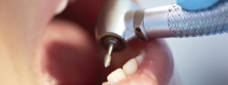 طراحی سایت خدمات دندانپزشکی - جلب مشتری